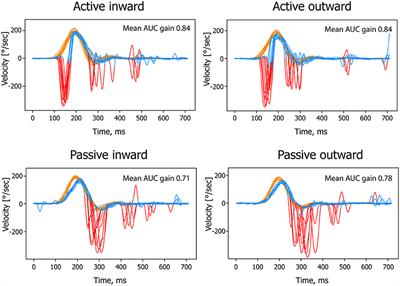 The Effect of Different Head Movement Paradigms on Vestibulo-Ocular Reflex Gain and Saccadic Eye Responses in the Suppression Head Impulse Test in Healthy Adult Volunteers